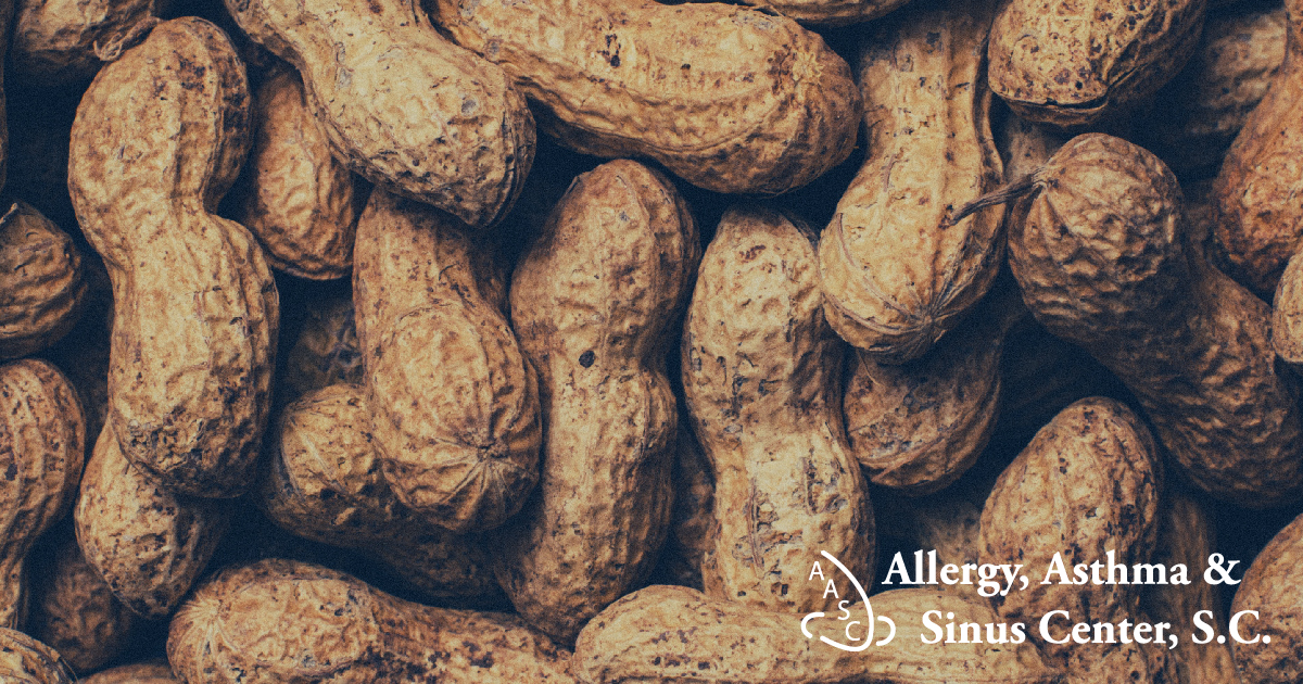 Are you able to enjoy peanuts?